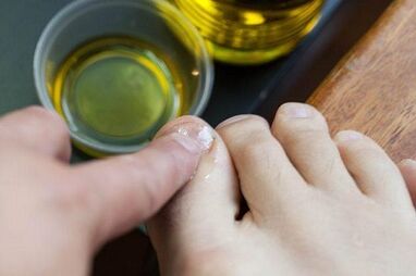 Treatment of fungus