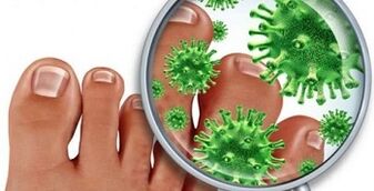 how to treat a fungal infection on the fingers