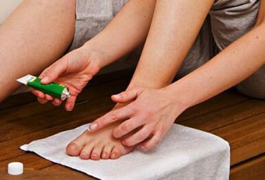 applying ointment to treat toenail fungus
