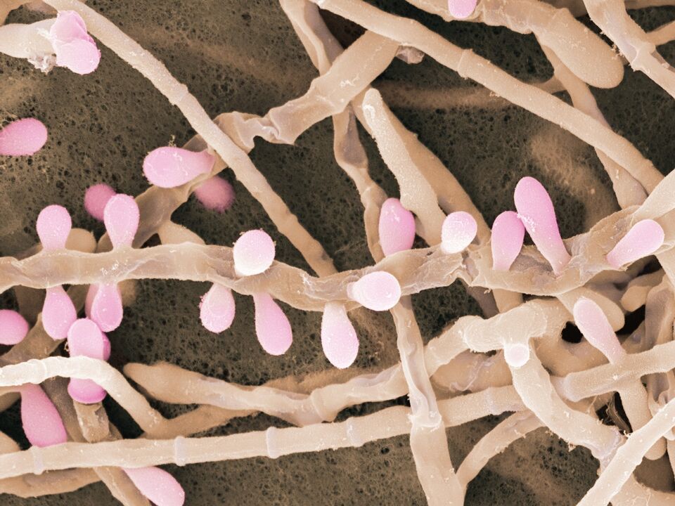 Trichophyton rubrum is a type of fungus that affects the skin of the feet.